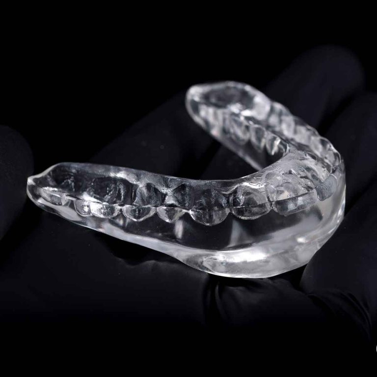dental-arch-model-sla-print
